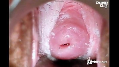 美女の婦人科検診